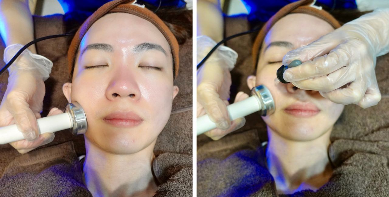 台北醫美診所推薦「元晨診所」海菲秀水飛梭真實體驗,非侵入式醫美保養分享! - 第10張圖 元晨診所