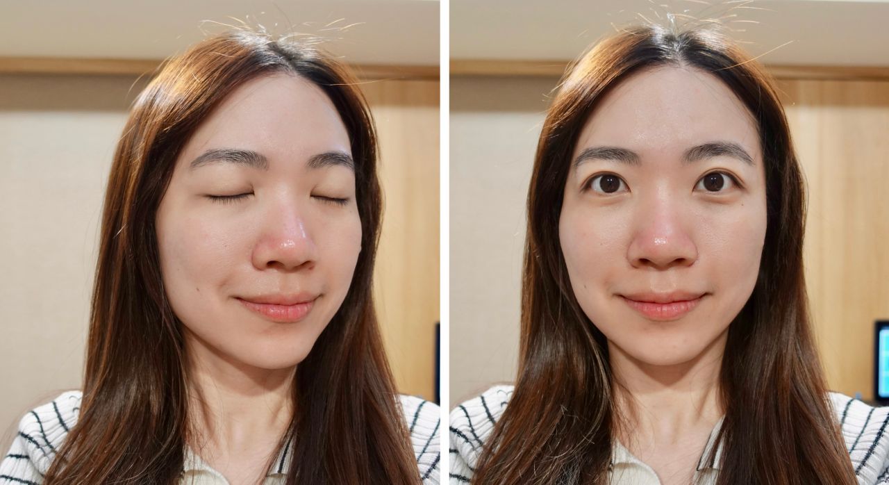 台北醫美診所推薦「元晨診所」海菲秀水飛梭真實體驗,非侵入式醫美保養分享! - 第12張圖 元晨診所